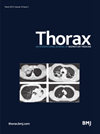 THORAX期刊封面