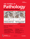 JOURNAL OF PATHOLOGY期刊封面