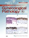 INTERNATIONAL JOURNAL OF GYNECOLOGICAL PATHOLOGY:妇科病理诊断标准化的全球锚点与临床转化核心