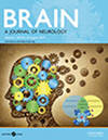 BRAIN期刊封面